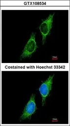 Anti-P2X2 antibody [C3], C-term used in Immunocytochemistry/ Immunofluorescence (ICC/IF). GTX108534