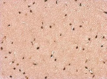 Anti-P2X2 antibody [C3], C-term used in IHC (Paraffin sections) (IHC-P). GTX108534