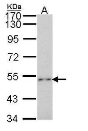 Anti-P2X2 antibody [C3], C-term used in Western Blot (WB). GTX108534