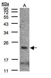 Anti-CMTM3 antibody [C1C3] used in Western Blot (WB). GTX108549