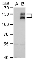 Anti-AXL antibody used in Western Blot (WB). GTX108560