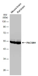 Anti-PACSIN1 antibody used in Western Blot (WB). GTX108567