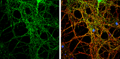 Anti-PACSIN1 antibody used in Immunocytochemistry/ Immunofluorescence (ICC/IF). GTX108567