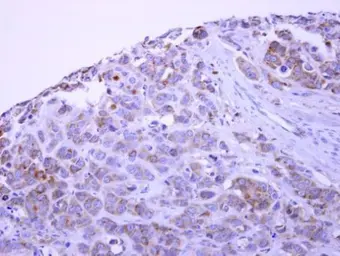 Anti-PACSIN1 antibody used in IHC (Paraffin sections) (IHC-P). GTX108567