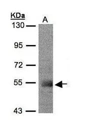 Anti-PACSIN1 antibody used in Western Blot (WB). GTX108567