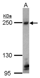 Anti-ZO-1 antibody [C3], C-term used in Western Blot (WB). GTX108587