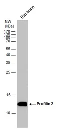 Anti-Profilin 2 antibody used in Western Blot (WB). GTX108589