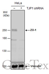 Anti-ZO-1 antibody used in Western Blot (WB). GTX108592