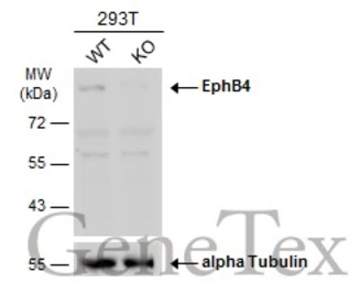 Anti-EphB4 antibody [N1N2], N-term used in Western Blot (WB). GTX108595