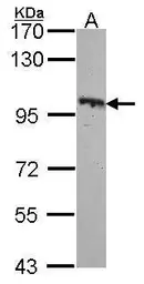 Anti-EphB4 antibody [N1N2], N-term used in Western Blot (WB). GTX108595