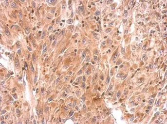 Anti-RhoB antibody used in IHC (Paraffin sections) (IHC-P). GTX108600