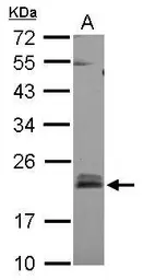 Anti-RhoB antibody used in Western Blot (WB). GTX108600