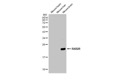 Anti-RAB2B antibody used in Western Blot (WB). GTX108606