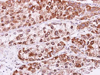 Anti-RAB2B antibody used in IHC (Paraffin sections) (IHC-P). GTX108606