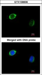 Anti-RAB2B antibody used in Immunocytochemistry/ Immunofluorescence (ICC/IF). GTX108606