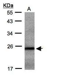 Anti-RAB2B antibody used in Western Blot (WB). GTX108606