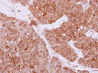 Anti-RAB4A antibody used in IHC (Paraffin sections) (IHC-P). GTX108607