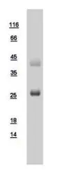 Human RAB3A protein, His tag. GTX108609-pro