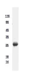 Human RAB3C protein, His tag. GTX108610-pro