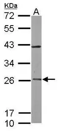Anti-RAB3C antibody [N1C3] used in Western Blot (WB). GTX108610