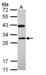 Anti-RAB3C antibody [N1C3] used in Western Blot (WB). GTX108610