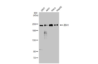 Anti-ZO-1 antibody [N1N2], N-term used in Western Blot (WB). GTX108613