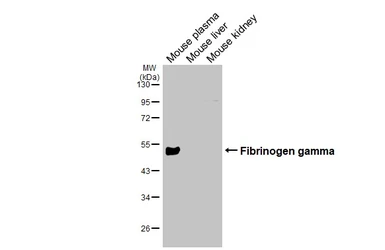 Anti-Fibrinogen gamma antibody used in Western Blot (WB). GTX108640