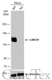 Anti-LIMCH1 antibody [C2C3], C-term used in Western Blot (WB). GTX108649