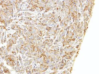 Anti-LIMCH1 antibody [C2C3], C-term used in IHC (Paraffin sections) (IHC-P). GTX108649