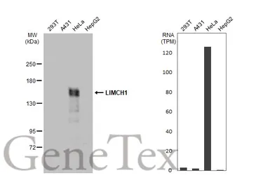 Anti-LIMCH1 antibody [C2C3], C-term used in Western Blot (WB). GTX108649