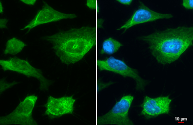Anti-LIMCH1 antibody [C2C3], C-term used in Immunocytochemistry/ Immunofluorescence (ICC/IF). GTX108649