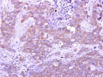 Anti-GIMAP5 antibody used in IHC (Paraffin sections) (IHC-P). GTX108652