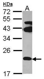 Anti-FAM18B antibody [N2C2], Internal used in Western Blot (WB). GTX108658
