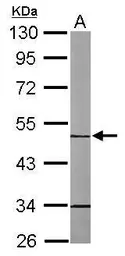Anti-MIPP antibody [N2C3] used in Western Blot (WB). GTX108680