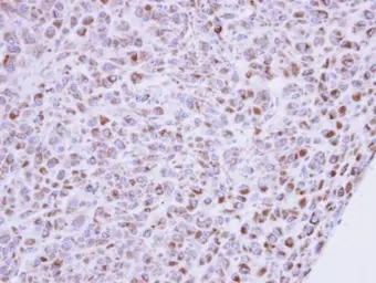 Anti-MIPP antibody [N2C3] used in IHC (Paraffin sections) (IHC-P). GTX108680
