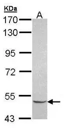 Anti-MIPP antibody [N2C3] used in Western Blot (WB). GTX108680