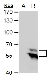 Anti-TdT antibody [C1C3] used in Western Blot (WB). GTX108697