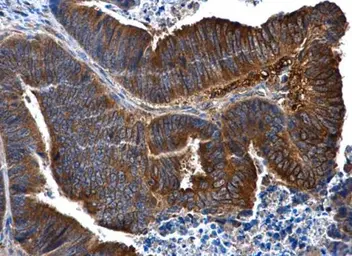 Anti-IL1 Receptor 2 antibody [N3C3] used in IHC (Paraffin sections) (IHC-P). GTX108702