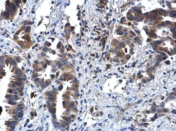 Anti-IL1 Receptor 2 antibody [N3C3] used in IHC (Paraffin sections) (IHC-P). GTX108702