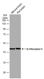 Anti-IL1 Receptor 2 antibody [N3C3] used in Western Blot (WB). GTX108702