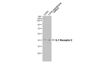 Anti-IL1 Receptor 2 antibody [N3C3] used in Western Blot (WB). GTX108702