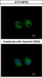 Anti-IL1 Receptor 2 antibody [N3C3] used in Immunocytochemistry/ Immunofluorescence (ICC/IF). GTX108702