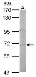 Anti-TR2 antibody [N1N3] used in Western Blot (WB). GTX108704
