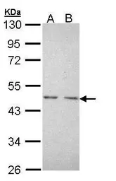 Anti-TR2 antibody [N1N3] used in Western Blot (WB). GTX108704