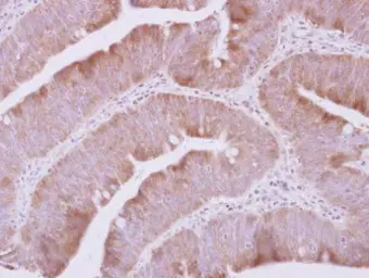 Anti-QARS antibody [N3C2], Internal used in IHC (Paraffin sections) (IHC-P). GTX108713