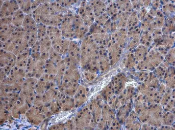 Anti-TrxR1 antibody [N3C2], Internal used in IHC (Paraffin sections) (IHC-P). GTX108727