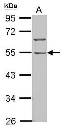 Anti-BTBD10 antibody [N3C3] used in Western Blot (WB). GTX108739