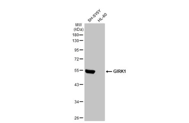Anti-GIRK1 antibody [N3C3] used in Western Blot (WB). GTX108745