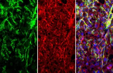 Anti-CD146 antibody [C1C3] used in IHC (Paraffin sections) (IHC-P). GTX108777
