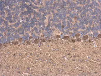 Anti-C17orf75 antibody [N1C1] used in IHC (Paraffin sections) (IHC-P). GTX108779